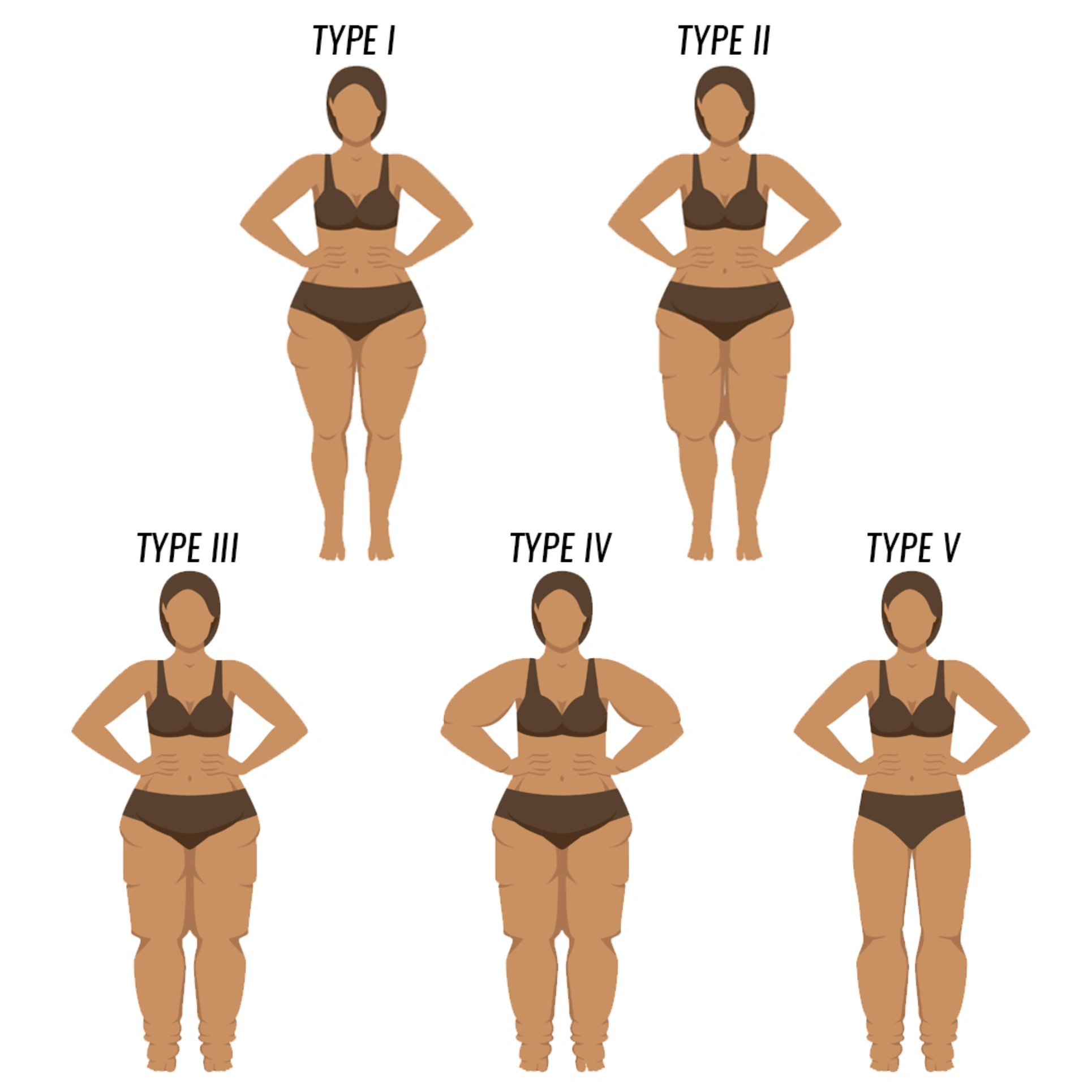 Female body types illustration for aesthetic balance.